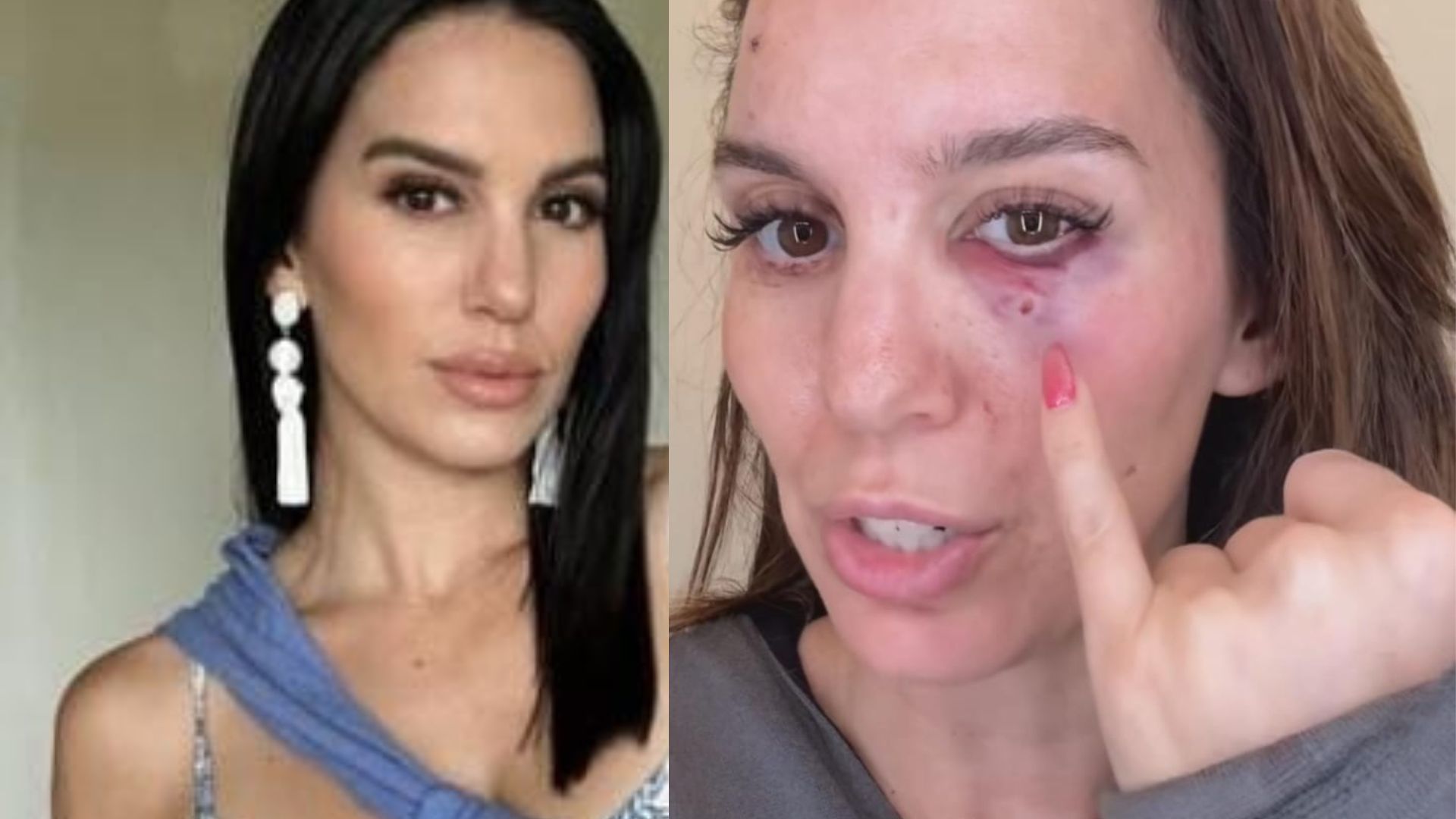 Christy Carlson Romano before and after her accident.(via Christy Carlson Romano on Instagram)