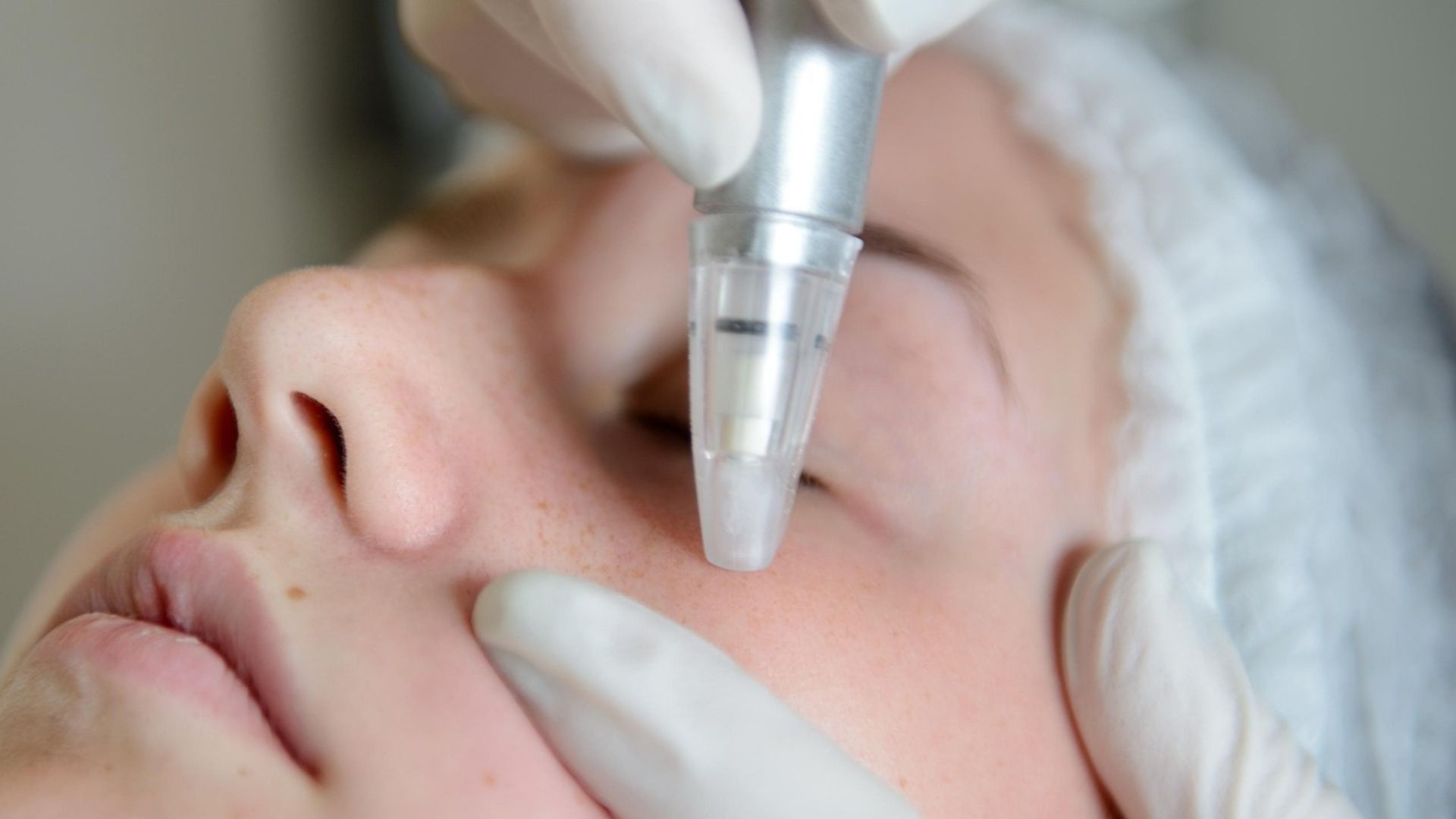 Microdermabrasion treatment (Image via Pixabay)