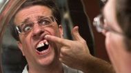 Stu's missing teeth scene in The Hangover | Image via Apple TV